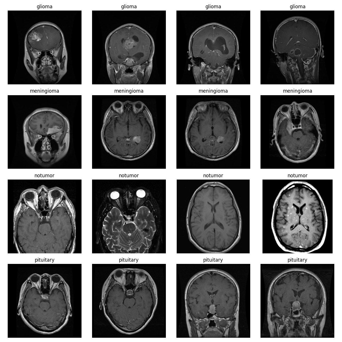 Brain Tumor Classification